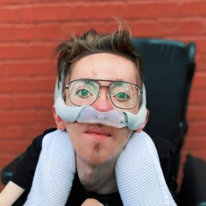 A man with brown hair, glasses, and a nasal cannula sits in a wheelchair looking at the camera.