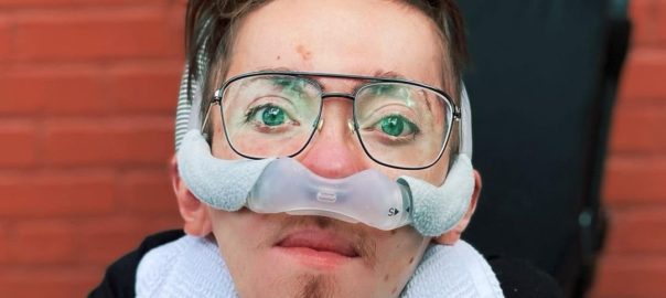 A man with brown hair, glasses, and a nasal cannula sits in a wheelchair looking at the camera.