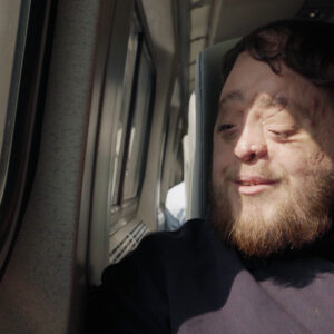 A bearded man with facial differences is sitting on the train looking out the window and smiling, while the sunlight hits his face.