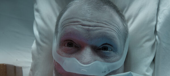 a man with an oxygen tube covering his nose.