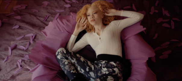 a young girl with albinism lying on a lilac-colored cushion, holding her arms on the sides of her head, as if posing to a camera